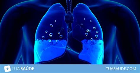 o que causa água no pulmão - o que é sujeito indeterminado